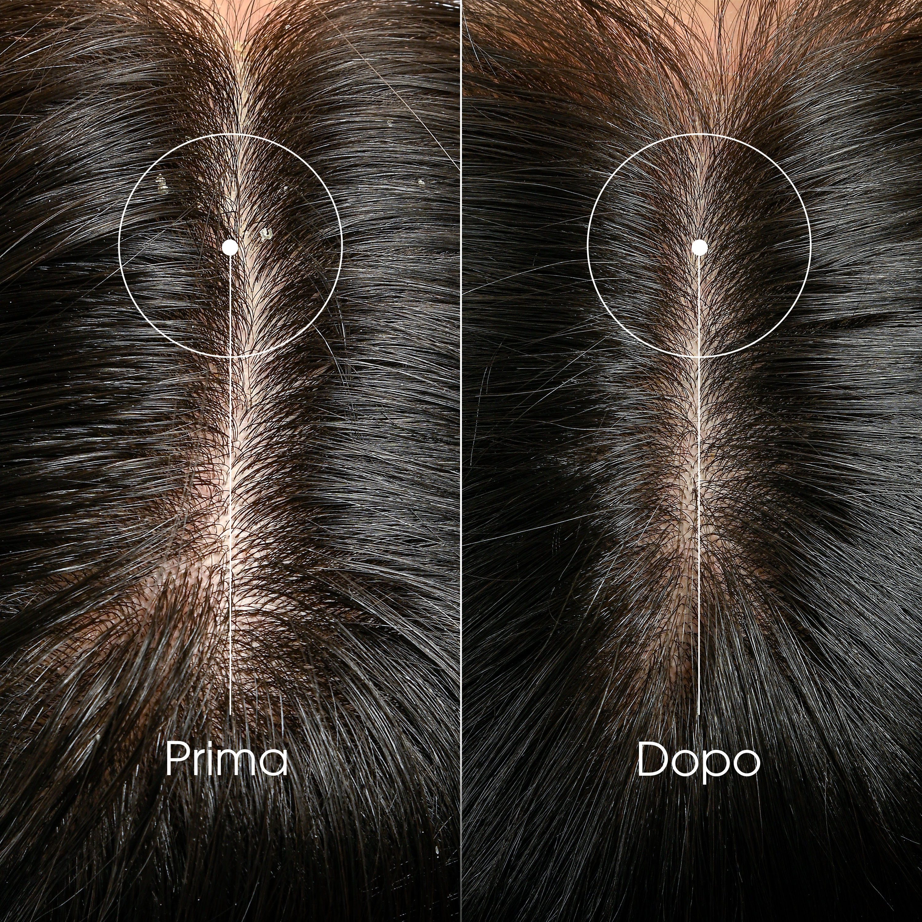 Klorane Anti-Forfora Shampoo trattante e riequilibrante alla Galanga, forfora secca e grassa, 400 ml