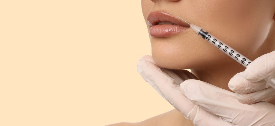 Filler labbra: cosa non fare dopo il trattamento per non compromettere il risultato