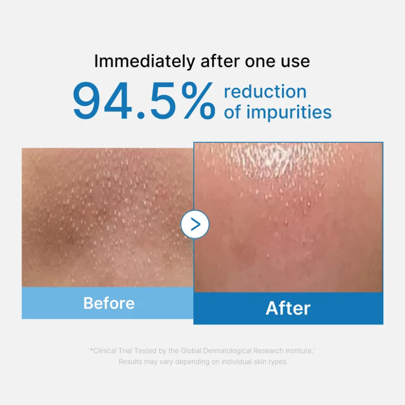 Medicube Zero Pore Blackhead Deep Cleansing Oil - Olio Detergente Viso 205 ml