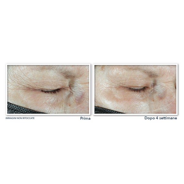 ROC Multi Correxion Hydrate + Plump Crema Occhi 15ml