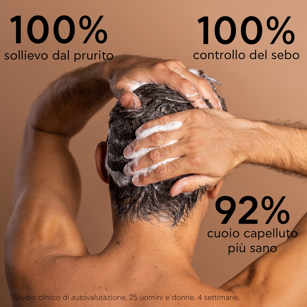 Apivita - Shampoo Forfora Grassa per Capelli 250ml - Trattamento Anti-Forfora