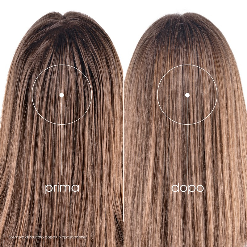 Klorane  Shampoo secco all'Ortica & Vitamina E, capelli grassi, purificante, 150ml 