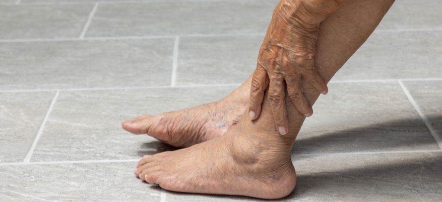 Gambe gonfie negli anziani: cause comuni, rimedi utili e quando preoccuparsi