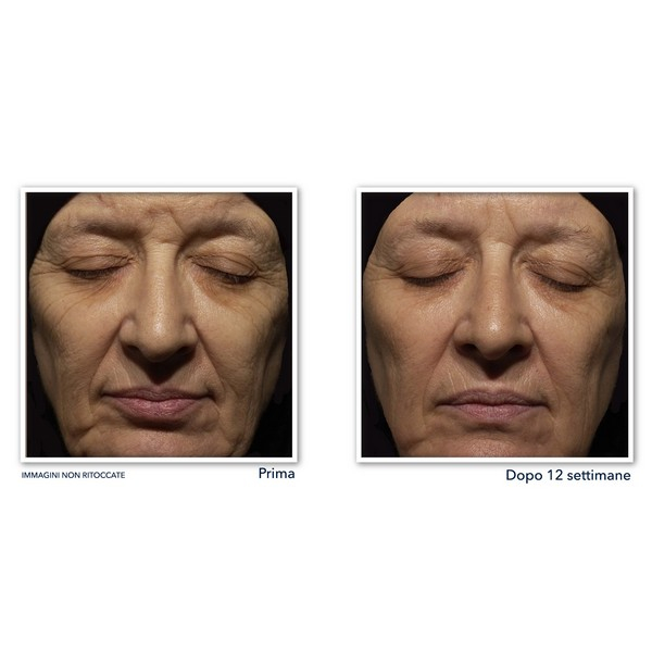 RoC Retinol Correxion® Wrinkle Correct Crema Viso Notte - 30ml