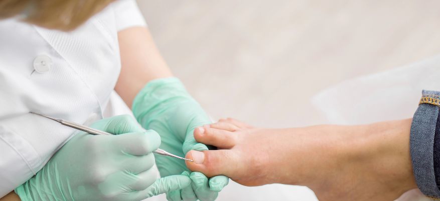 Unghie incarnite rimedi efficaci: come trattarle e prevenirle