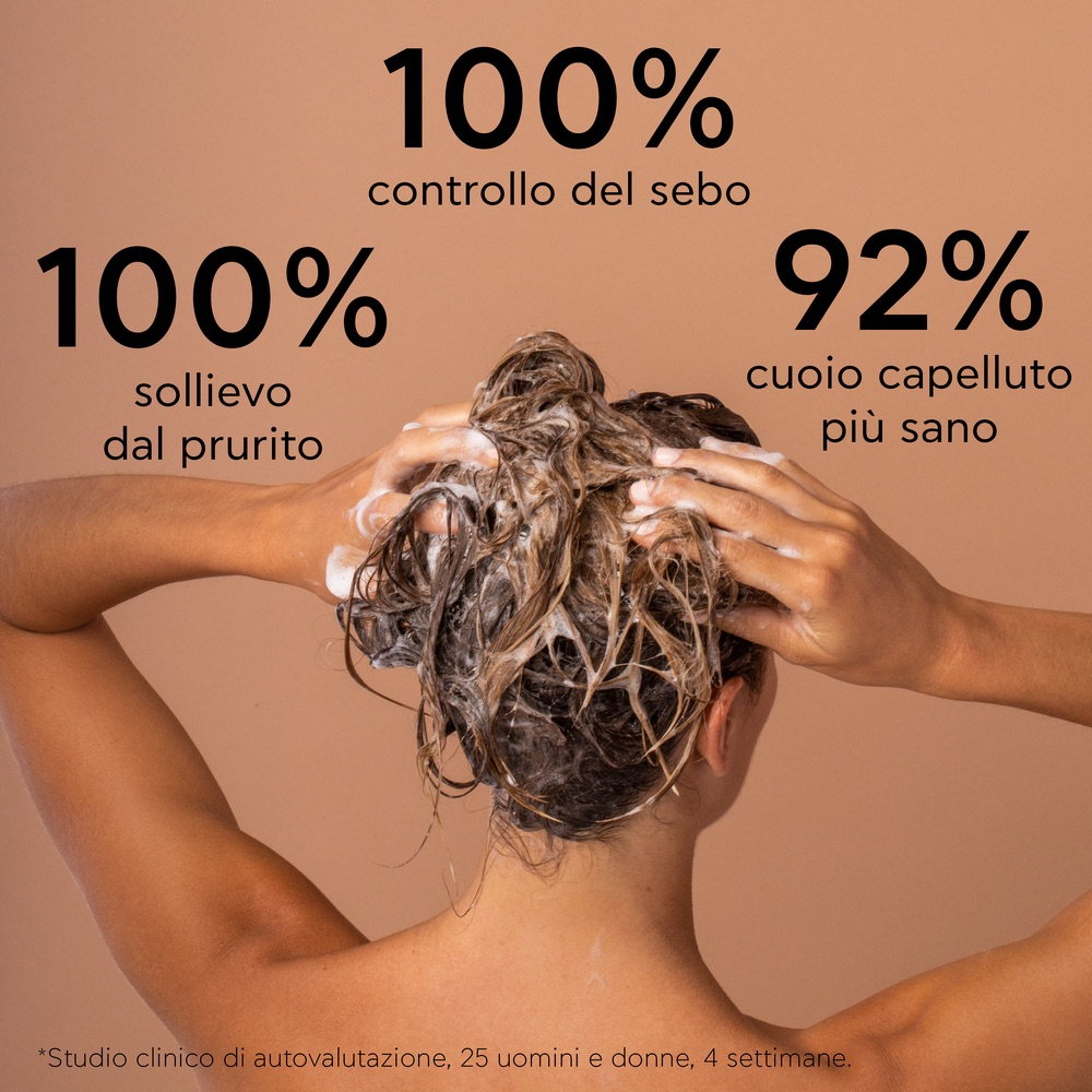 Apivita - Shampoo Forfora Grassa per Capelli 250ml - Trattamento Anti-Forfora