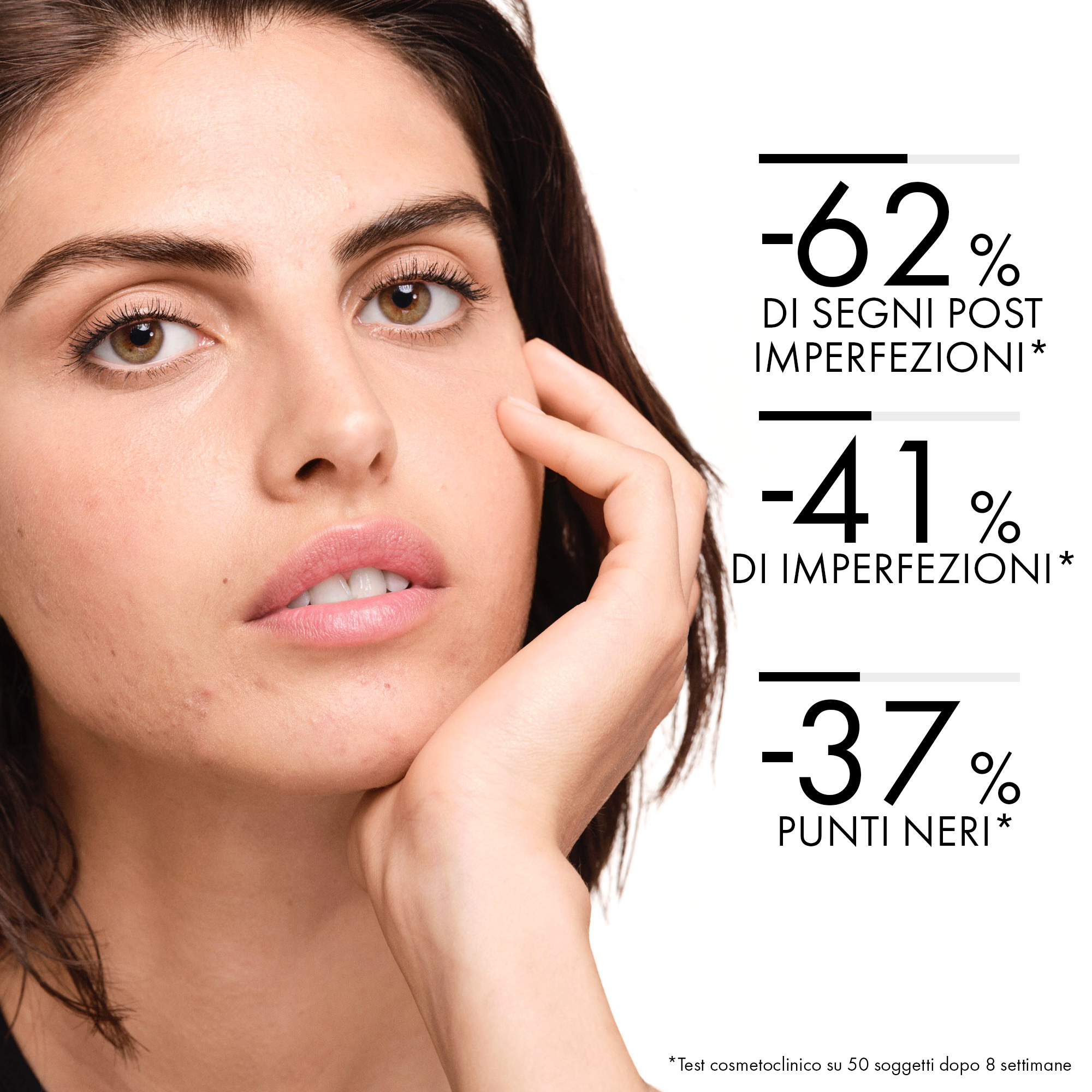 Vichy Normaderm Trattamento Idratante Doppia Azione per pelle a tendenza acneica 50 ml