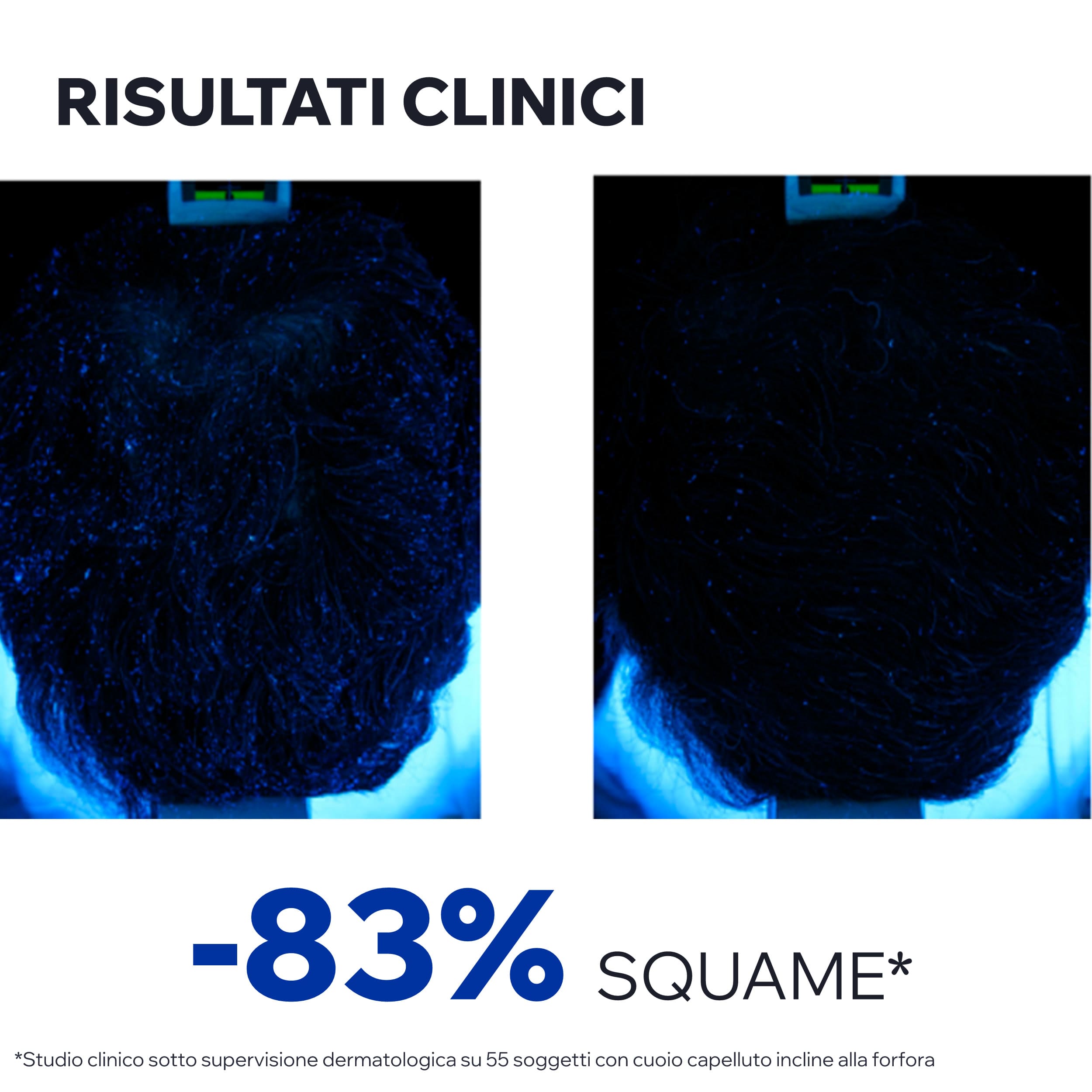 Uriage - DS Hair Lotion - Spray Lenitivo Regolatore Per Cuoio Capelluto 100 ml