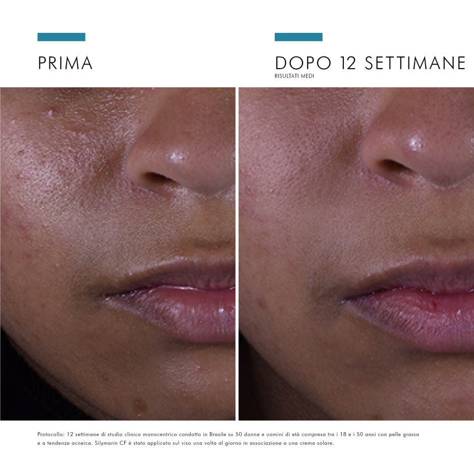 SkinCeuticals Silymarin CF Siero antiossidante con Vitamina C pura ideale per pelli grasse 30 ml