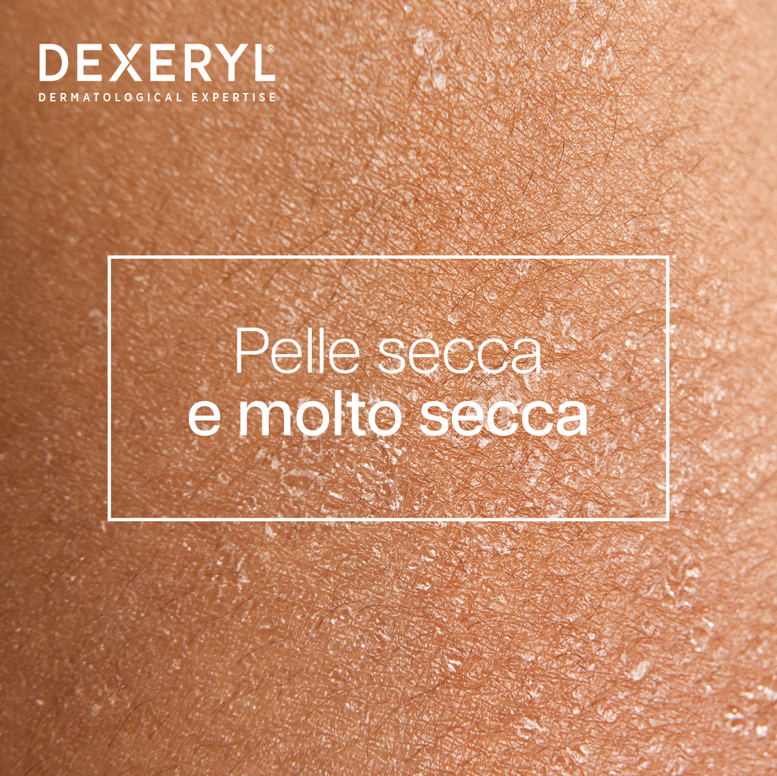 Dexeryl - Latte Nutritivo Per Pelle Secca E Molto Secca Di Viso E Corpo 200 ml