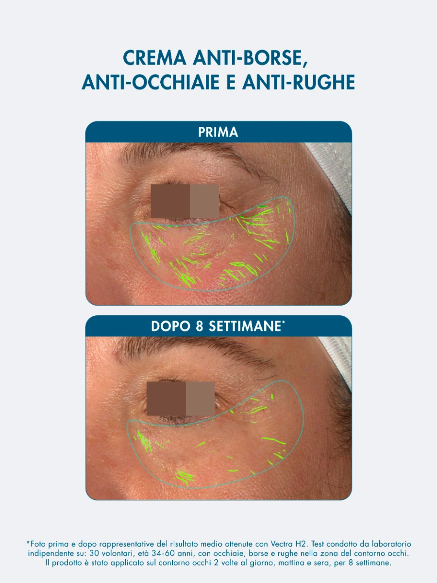 Miamo Supreme Anti-Fatigue Eye Cream - Crema Contorno Occhi Refill 15 ml
