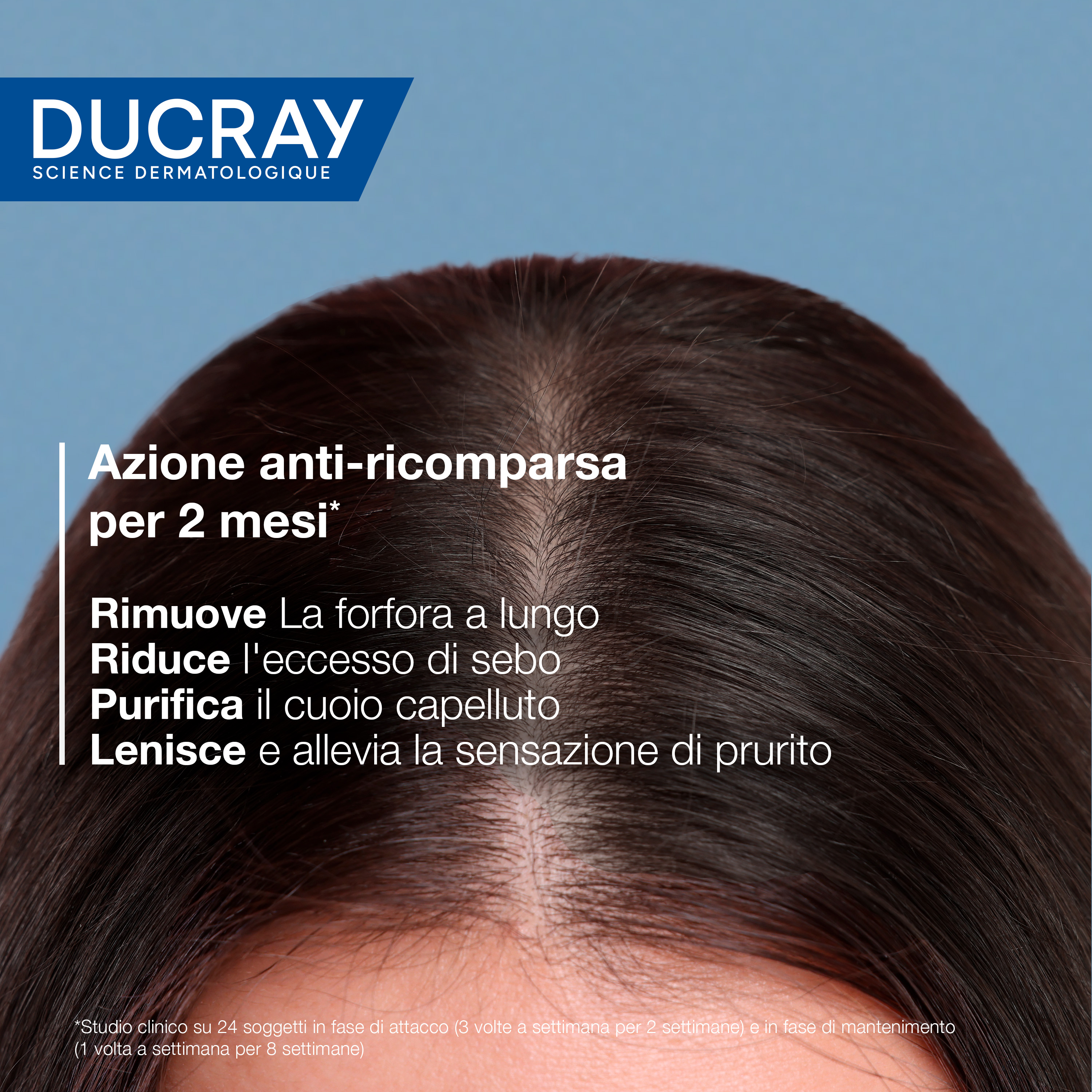 Ducray Kelual Squanorm Shampoo Trattante Regolatore Forfora Grassa, Elimina 100% della forfora, Azione anti-ricomparsa, Cuoio capelluto grasso, 400ml 