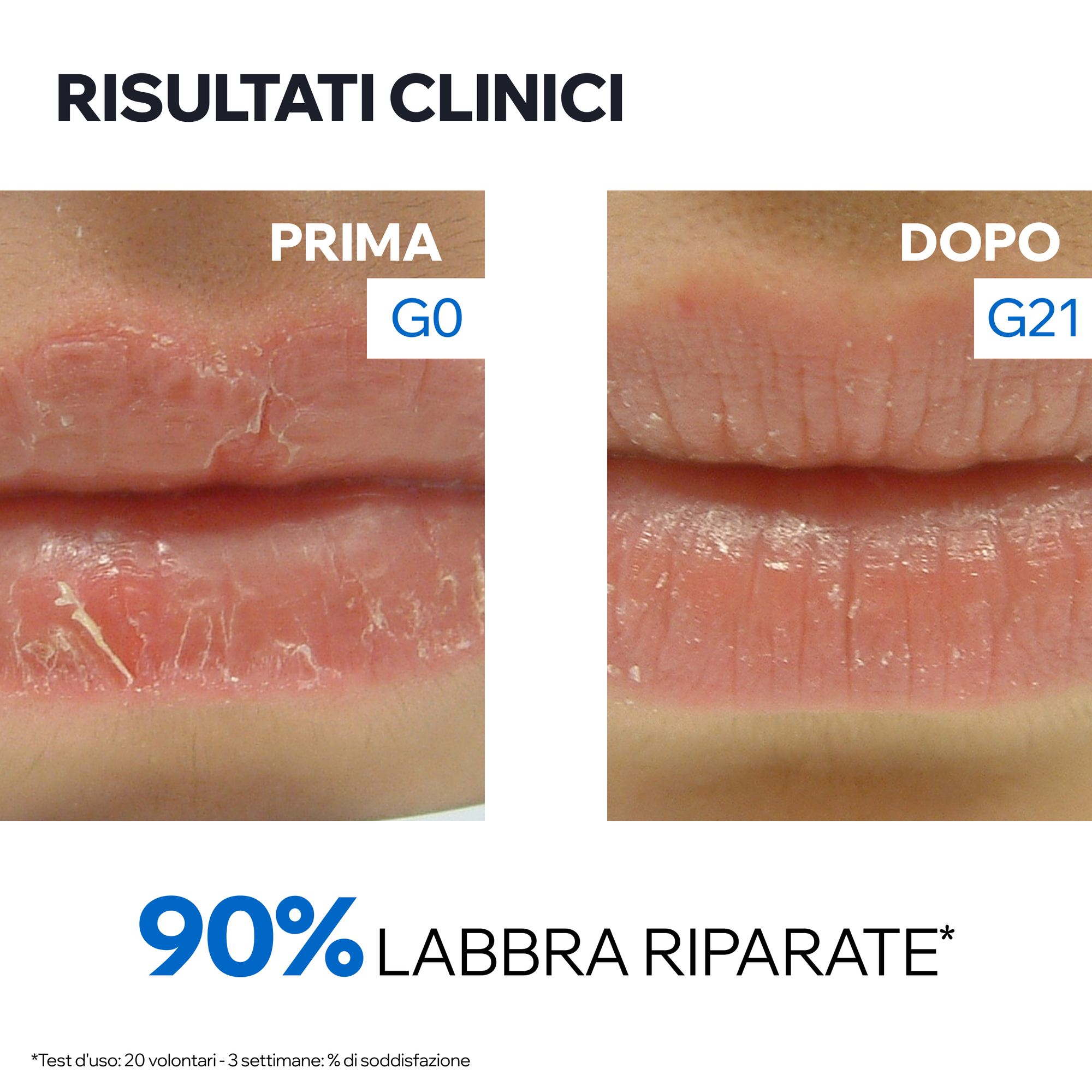 Uriage Bariéderm Cica-Levres - Balsamo Riparatore Protettivo Per Labbra Secche E Screpolate 15 ml