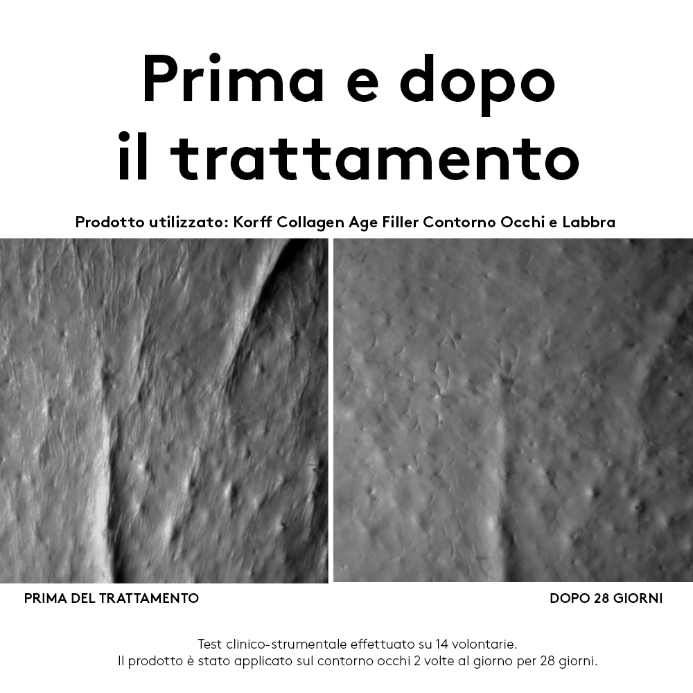 COLLAGEN AGE FILLER CONTORNO OCCHI E LABBRA