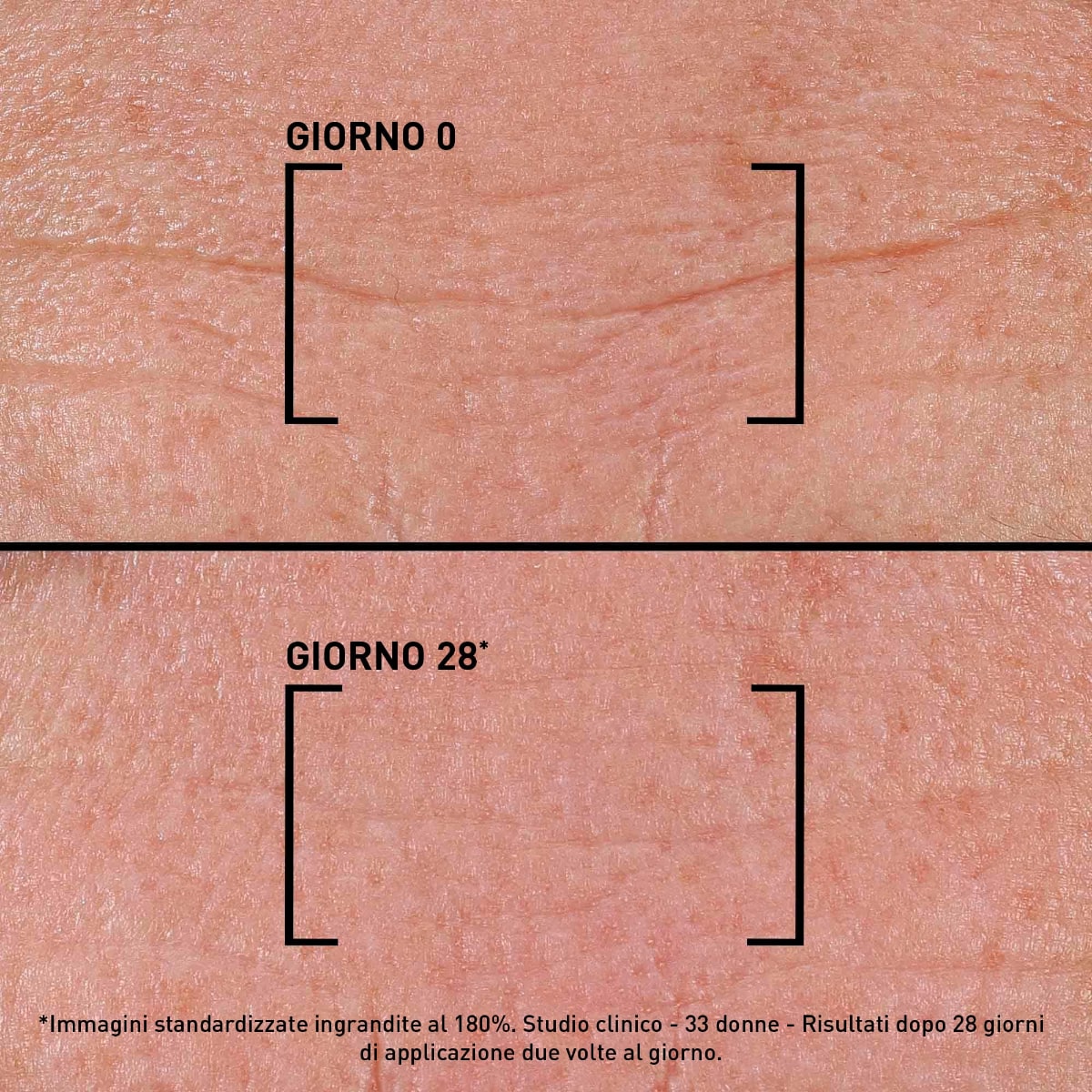 Filorga Time Filler Intensive 5xp Siero Rughe Viso E Collo