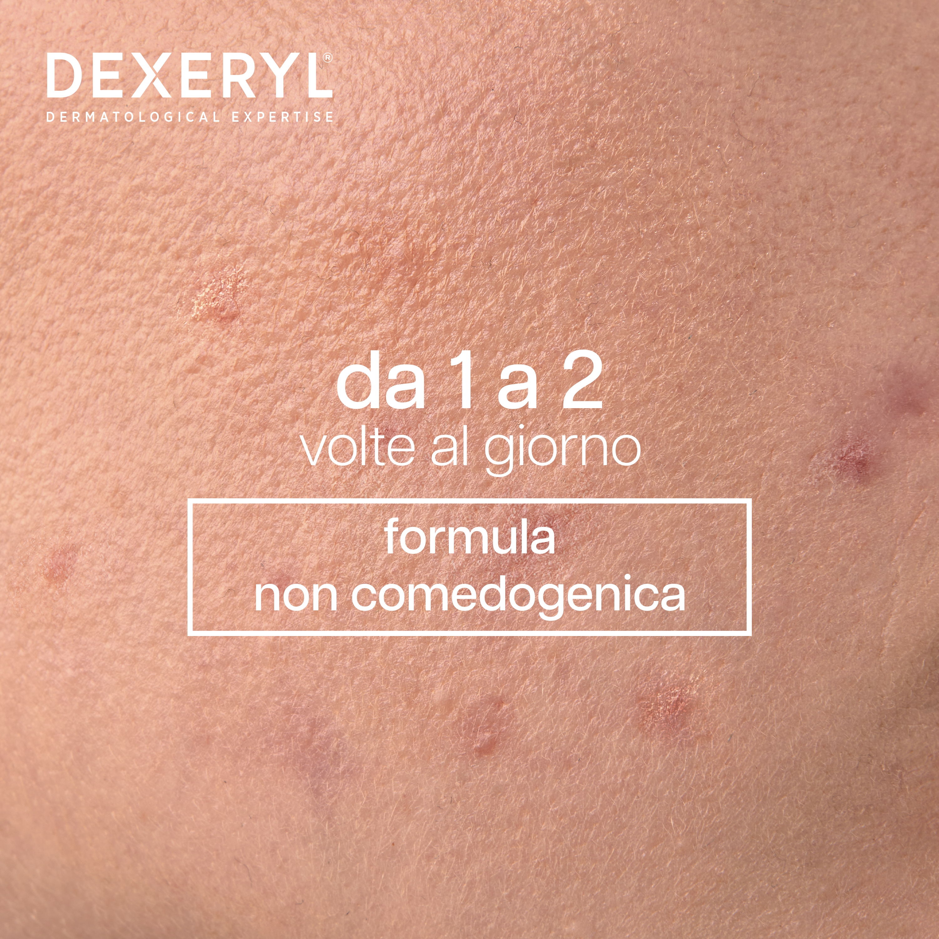 Dexeryl Dexeclear - Detergente Idratante Lenitivo Per Pelle Grassa E A Tendenza Acneica 400 ml