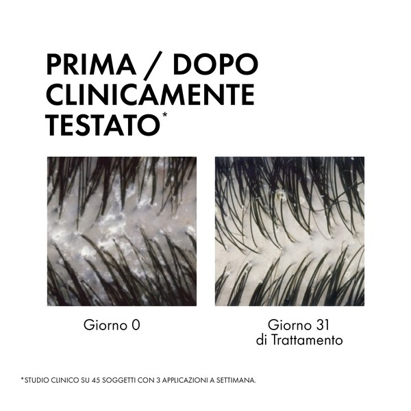 Vichy Dercos 2in1 Shampoo + Balsamo Anti-forfora DS? trattante dermatologico 200ml