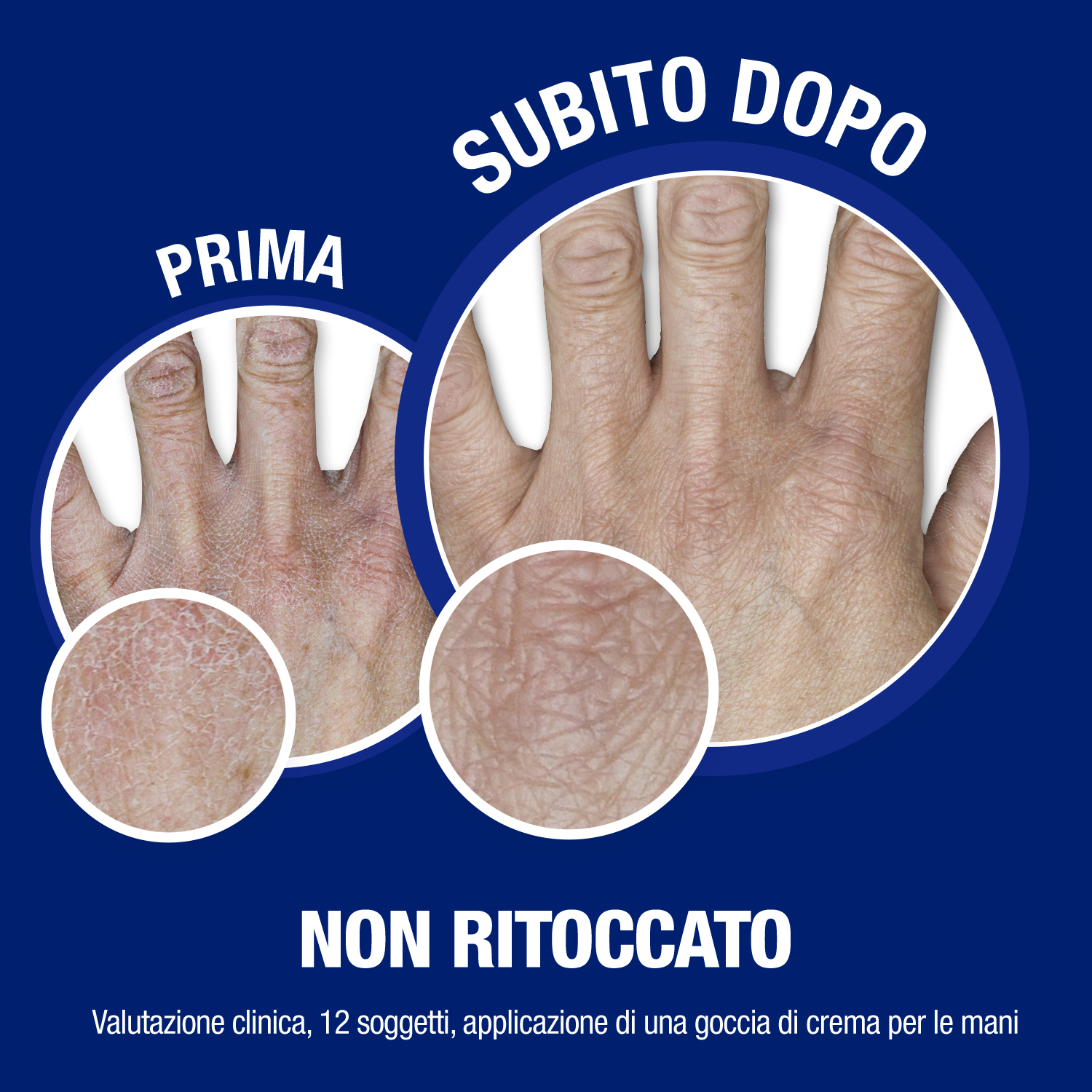 Neutrogena Formula Norvegese Crema Mani Assorbimento Rapido 150 ml, Crema mani secche e screpolate