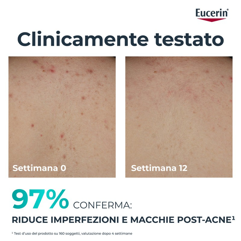 EUCERIN DC CREMA CRP TRIPLA AZ