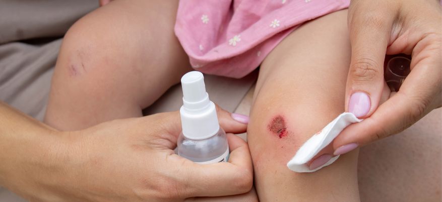 Come disinfettare una ferita: guida pratica e consigli utili