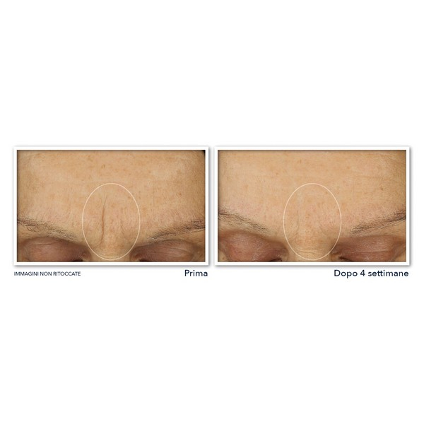 Retinol Correxion® Line Smoothing Crema Viso Massima Idratazione 50ml