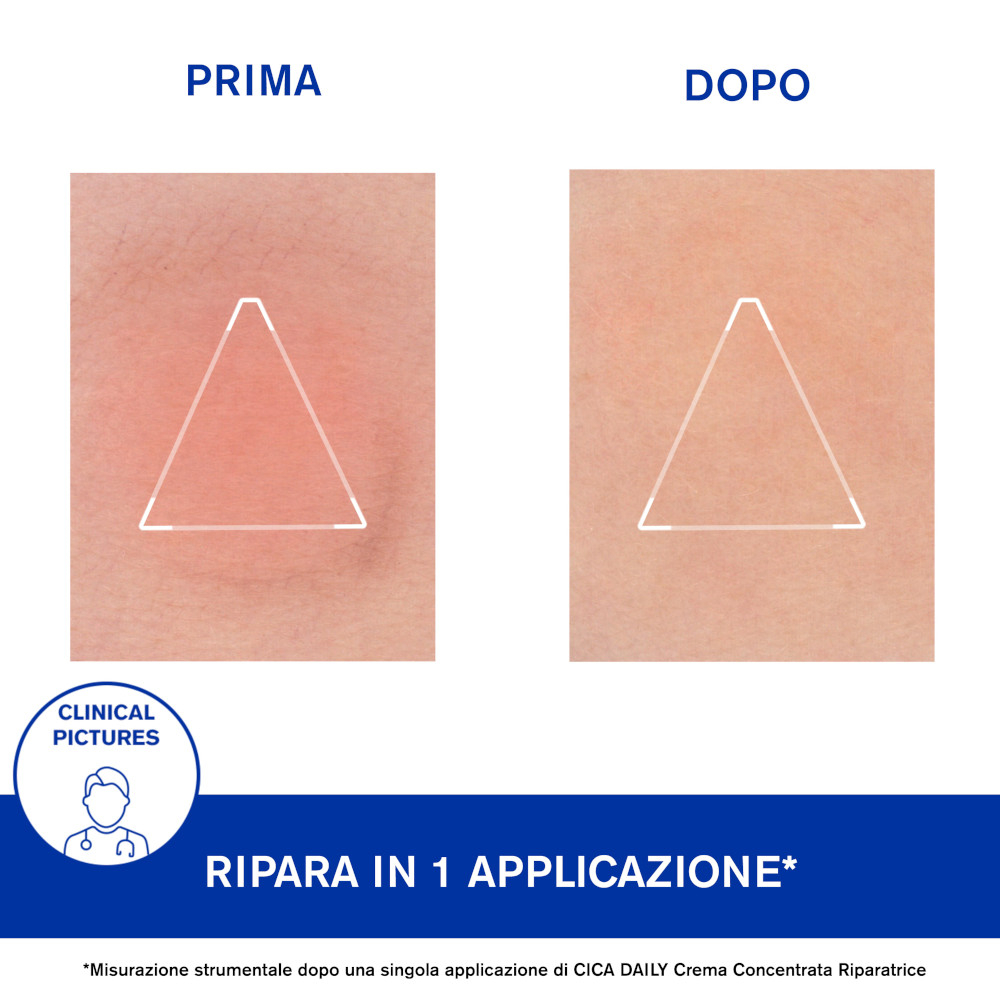 Uriage Cica Daily Crema Concentrata Riparatrice