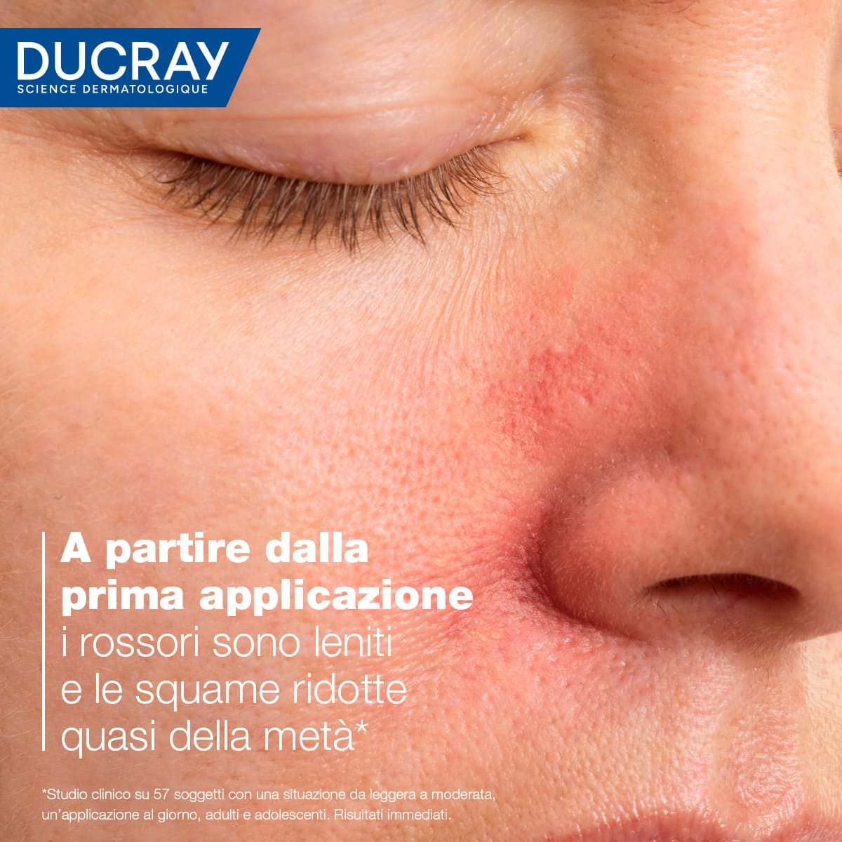 DUCRAY KELUAL DS Crema*40ml