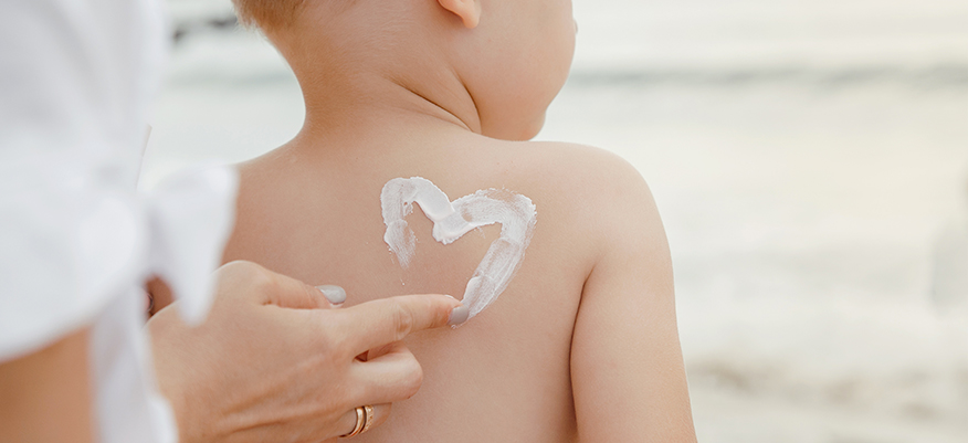 Eritema solare e bambini: come prevenirlo e curarlo
