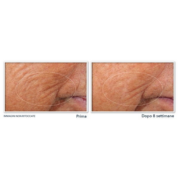 ROC Retinol Correxion Line Smoothing Siero Viso Notte Levigante - Siero antirughe in capsule - 30 capsule