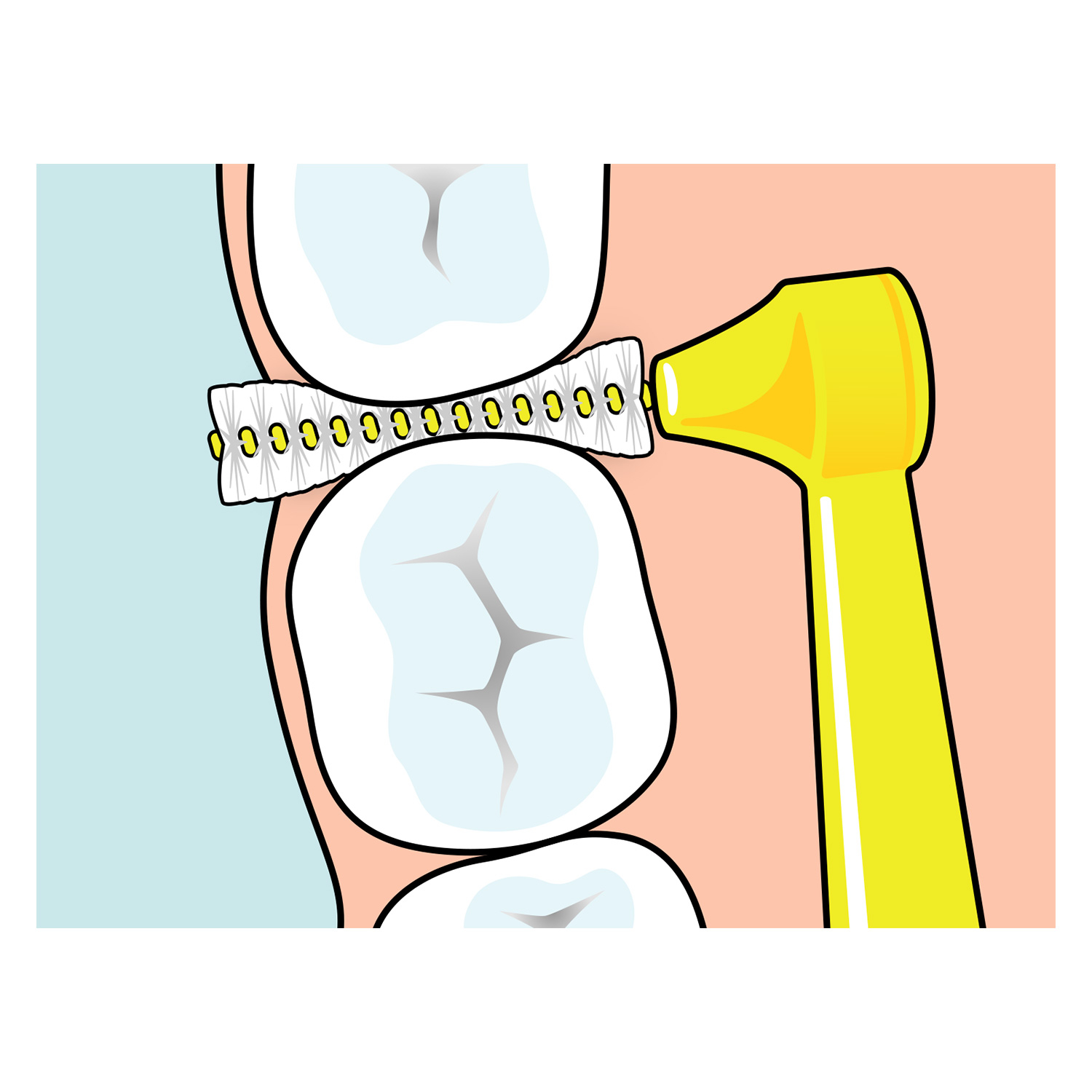 TePe Angle Scovolino Angolato Arancione Con Filo Interdentale 0,45 mm