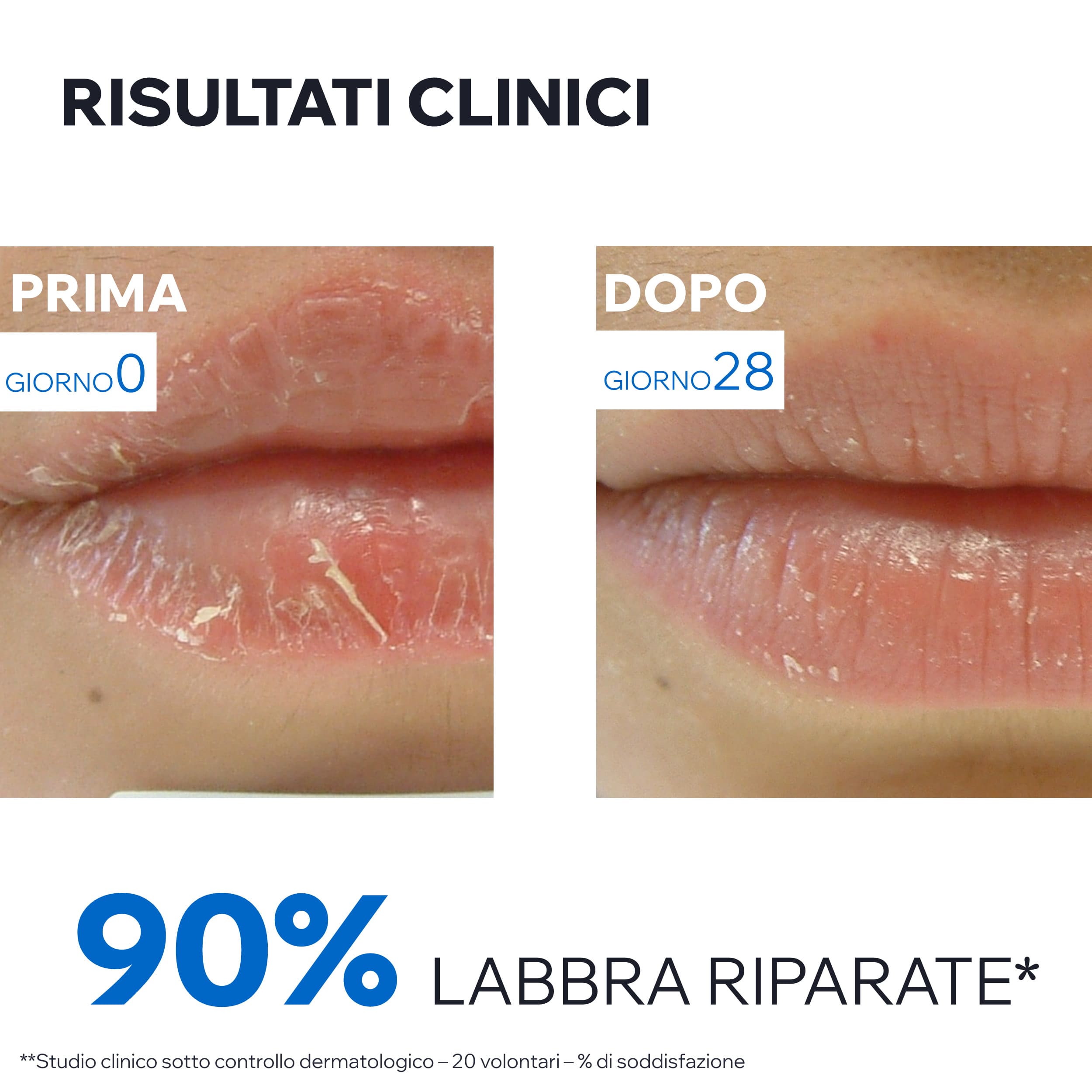 Uriage Bariéderm Cica-Levres Balsamo Labbra Secche Screpolate 15 ml