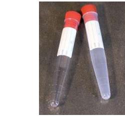 PROVETTA CONICA URINA 10ML