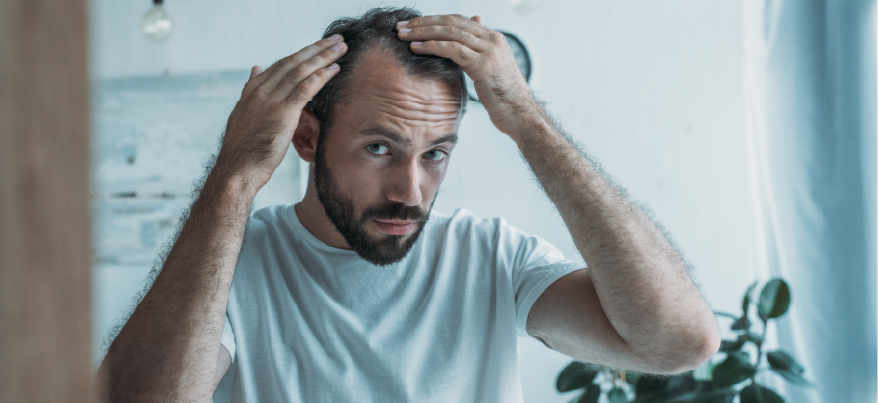 Prevenire la caduta dei capelli: scopri i prodotti ideali
