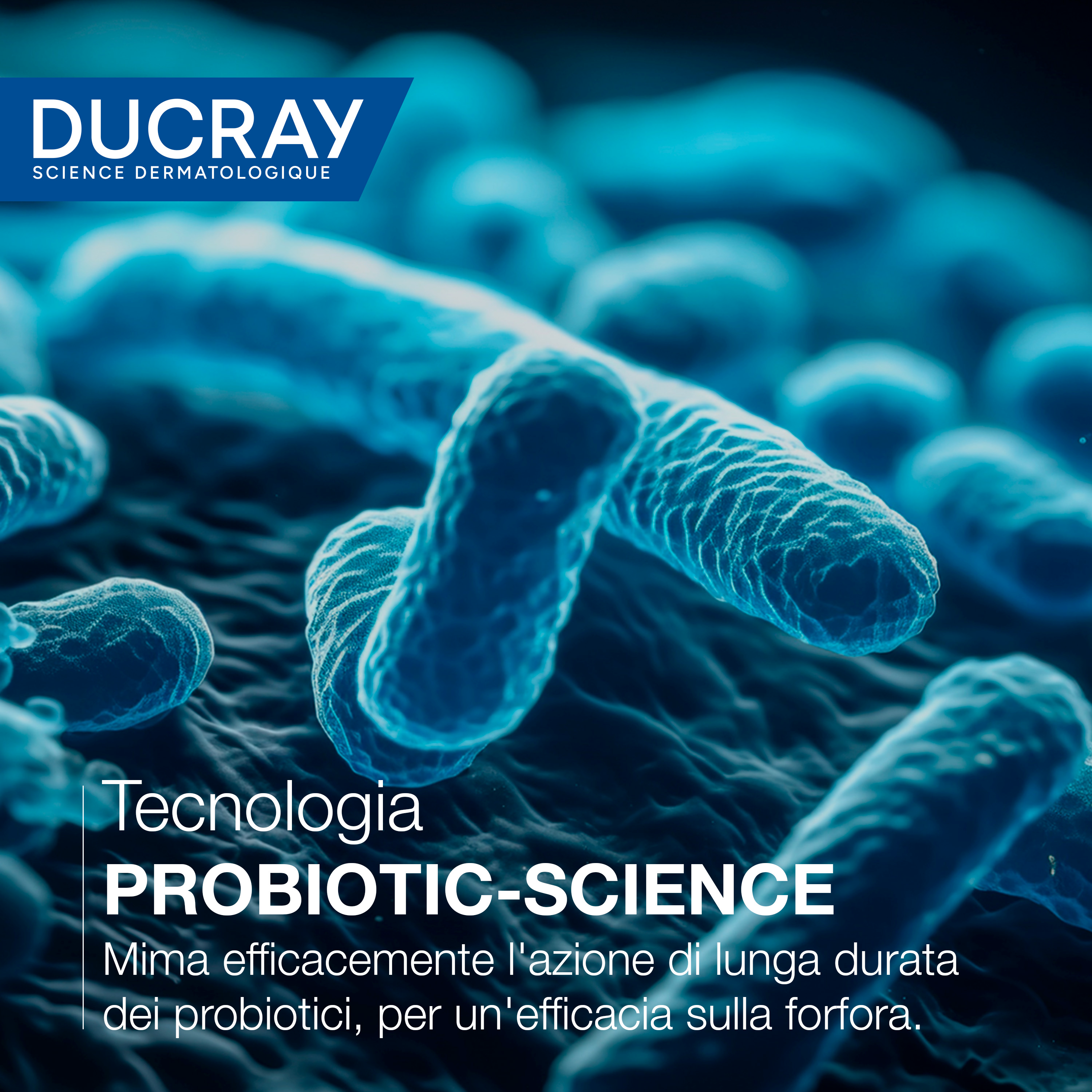 Ducray Kelual Squanorm Shampoo Trattante Idratante Forfora Secca, Elimina 100% della forfora, Azione anti-ricomparsa, Cuoio capelluto secco 400ml 