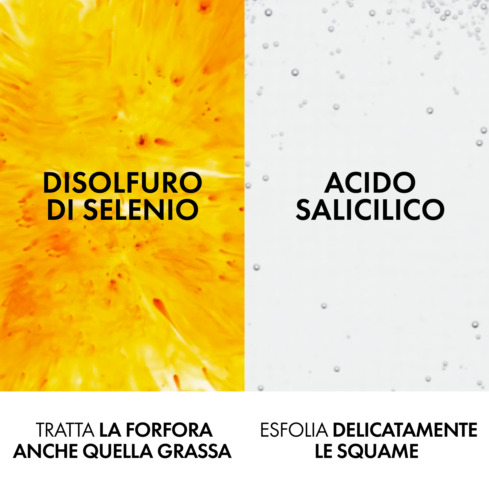 Vichy Dercos Shampoo trattante Anti-forfora DS per capelli da normali a grassi 400 ml