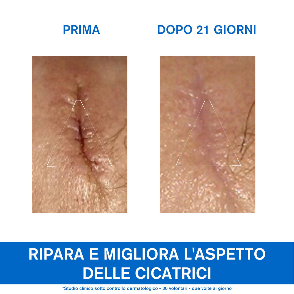 URIAGE BARIÉDERM-CICA Crema dermatologica multiuso per la riparazione della pelle alterata 40 ml