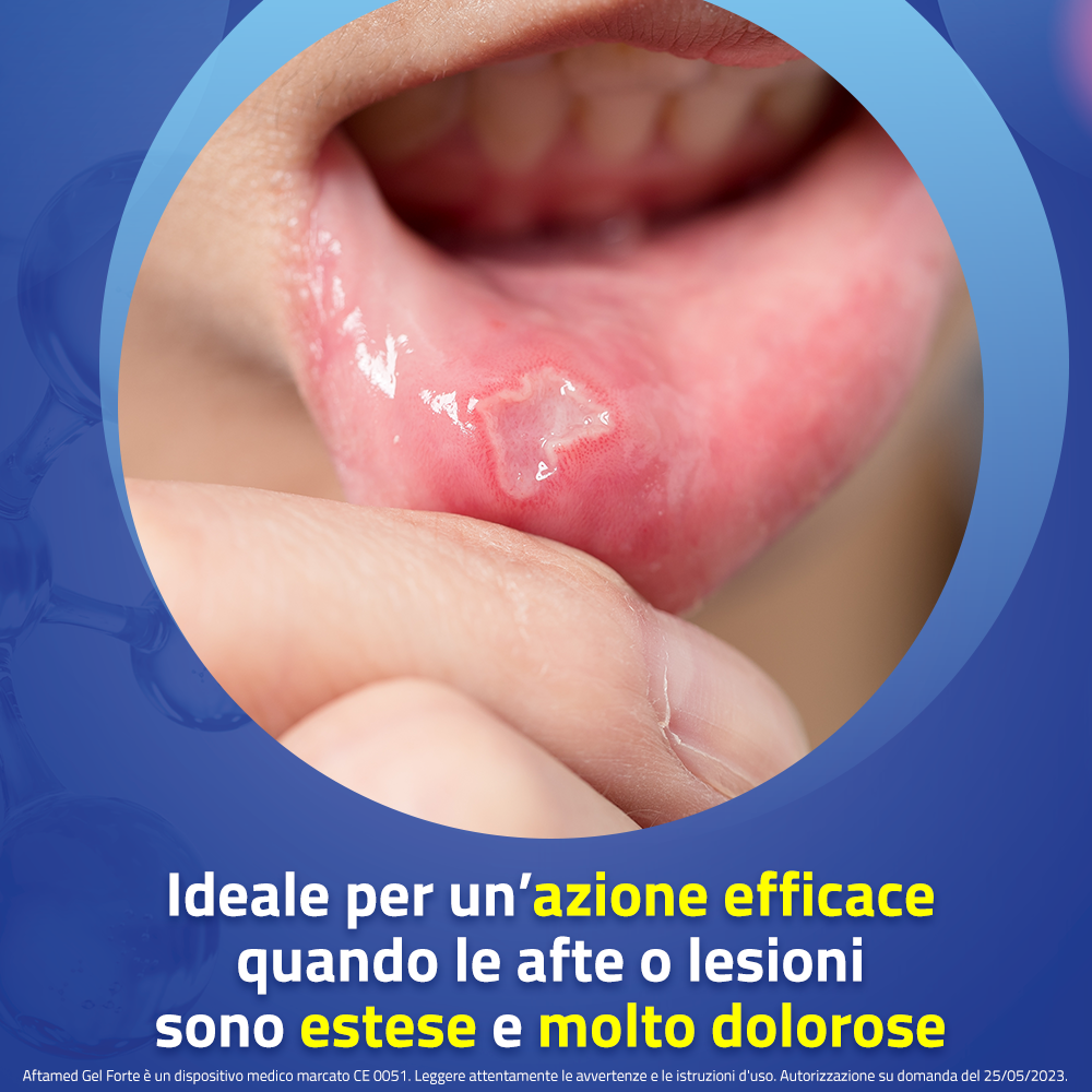 Aftamed Scudo Gel Anti-Afte 8 ml