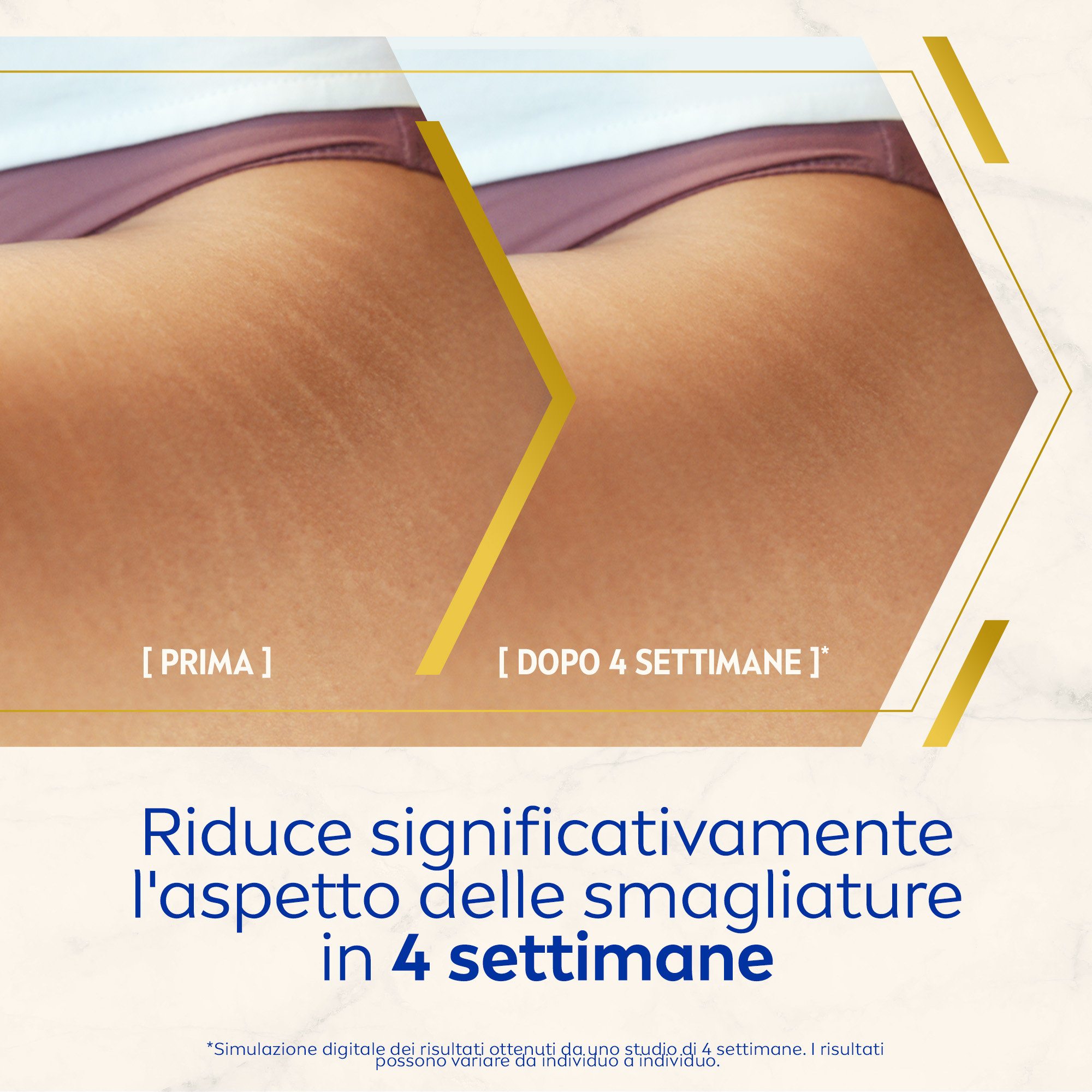 Nivea Luminous630 Olio-Siero Corpo Antismagliature 100 ml, Olio per la cura corpo antismagliature