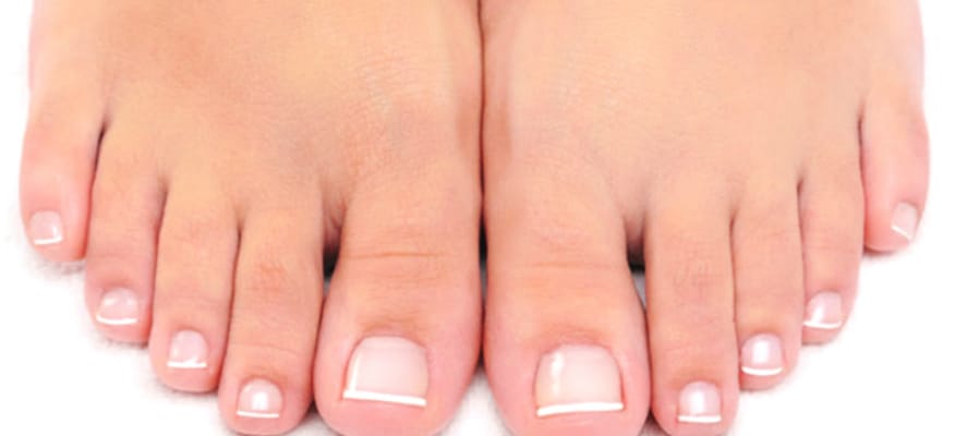 Come curare la micosi delle unghie