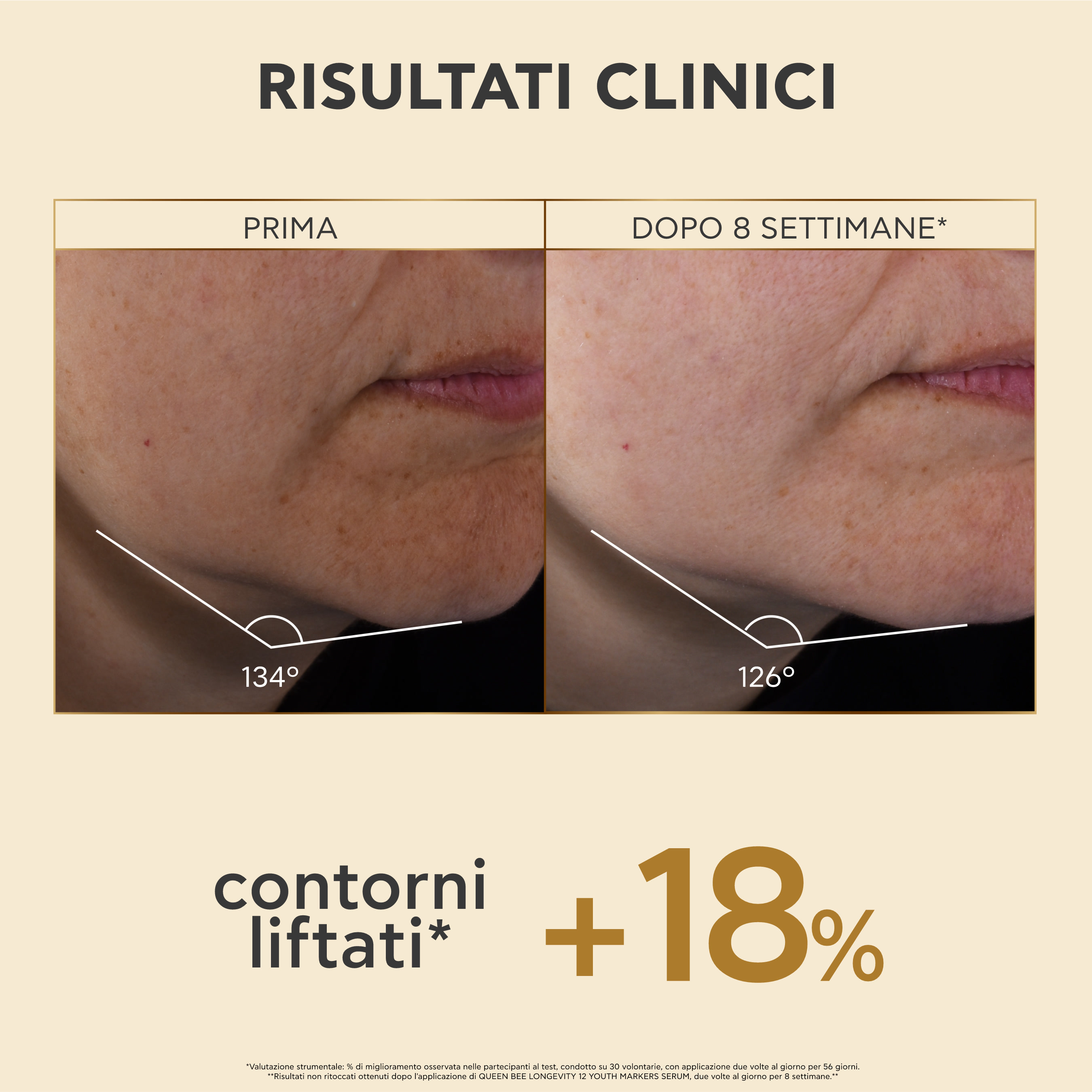 Apivita Queen Bee Longevity - Siero Viso Antiage 12 Indicatori Di Giovinezza 30 ml