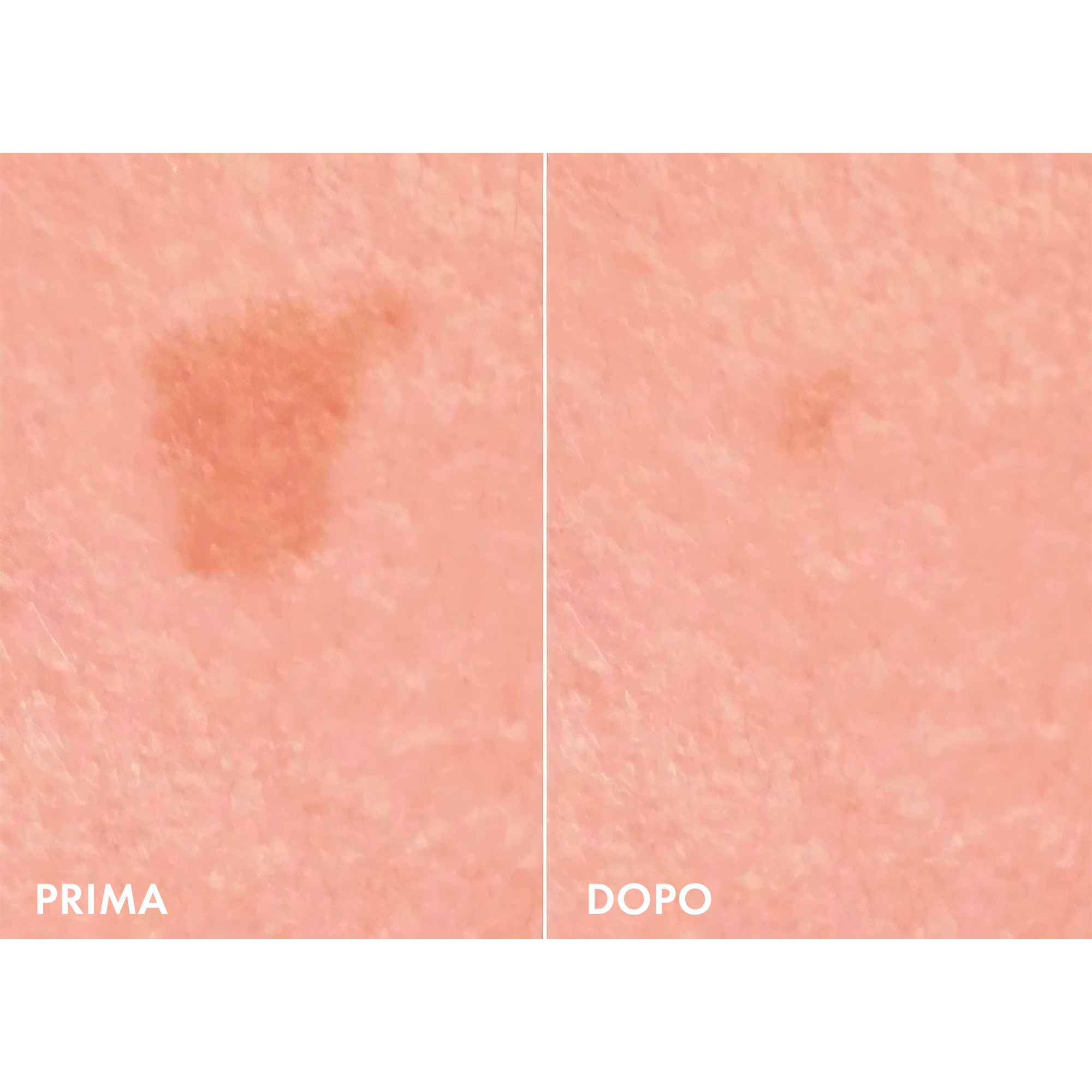 LIFTACTIV B3 SPF50 50ML