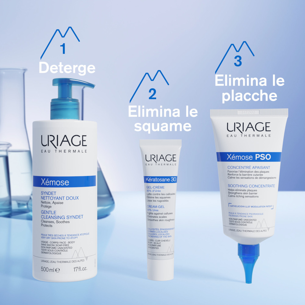 XEMOSE PSO TRATTAM CONC 150ML