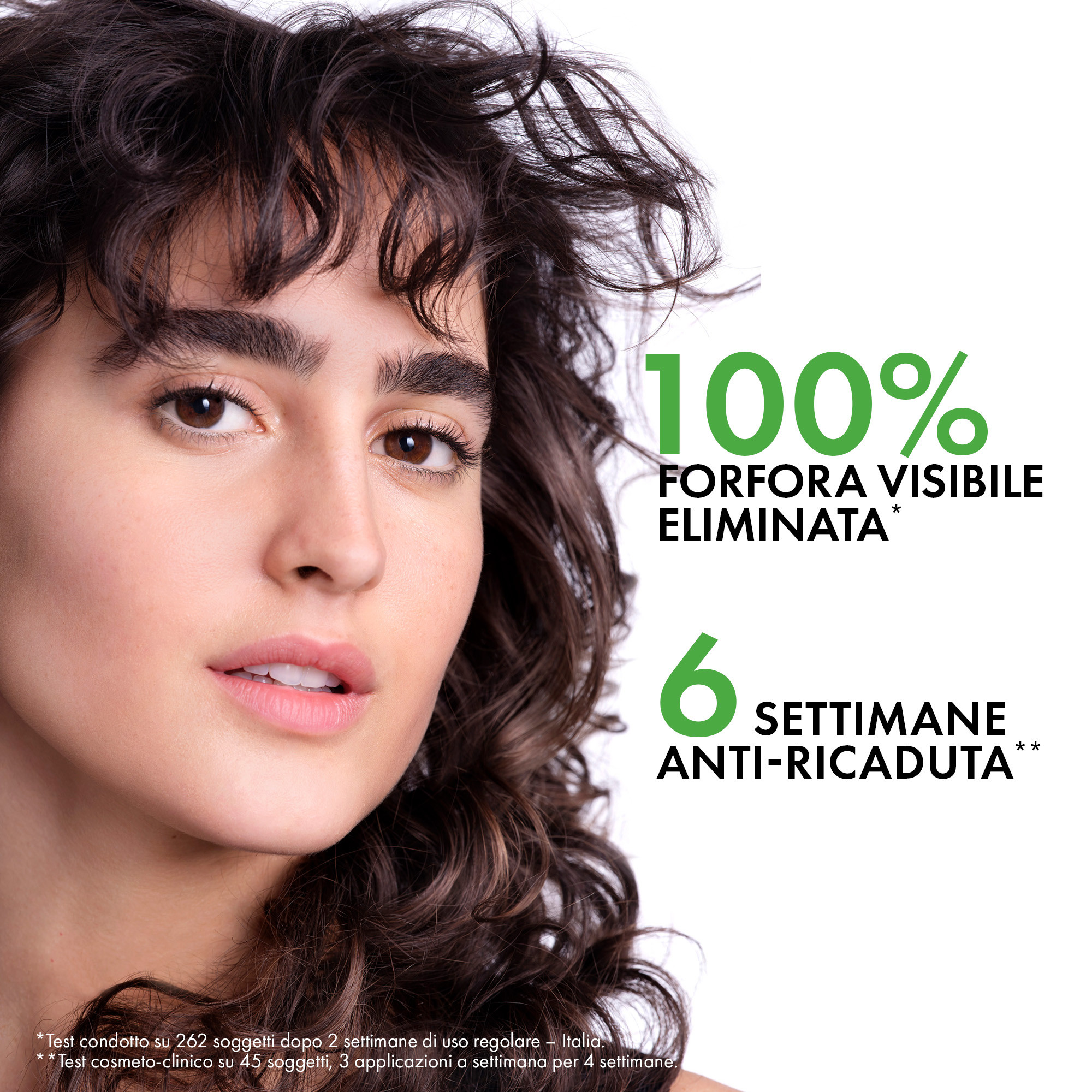 Vichy Dercos Technique Shampoo Antiforfora Ds Grassi per Forfora e Prurito 390ml