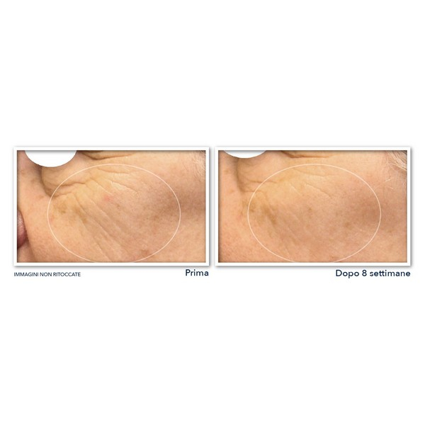 Roc Multi Correxion® Revive + Glow Siero Viso Notte in Capsule - 30cps