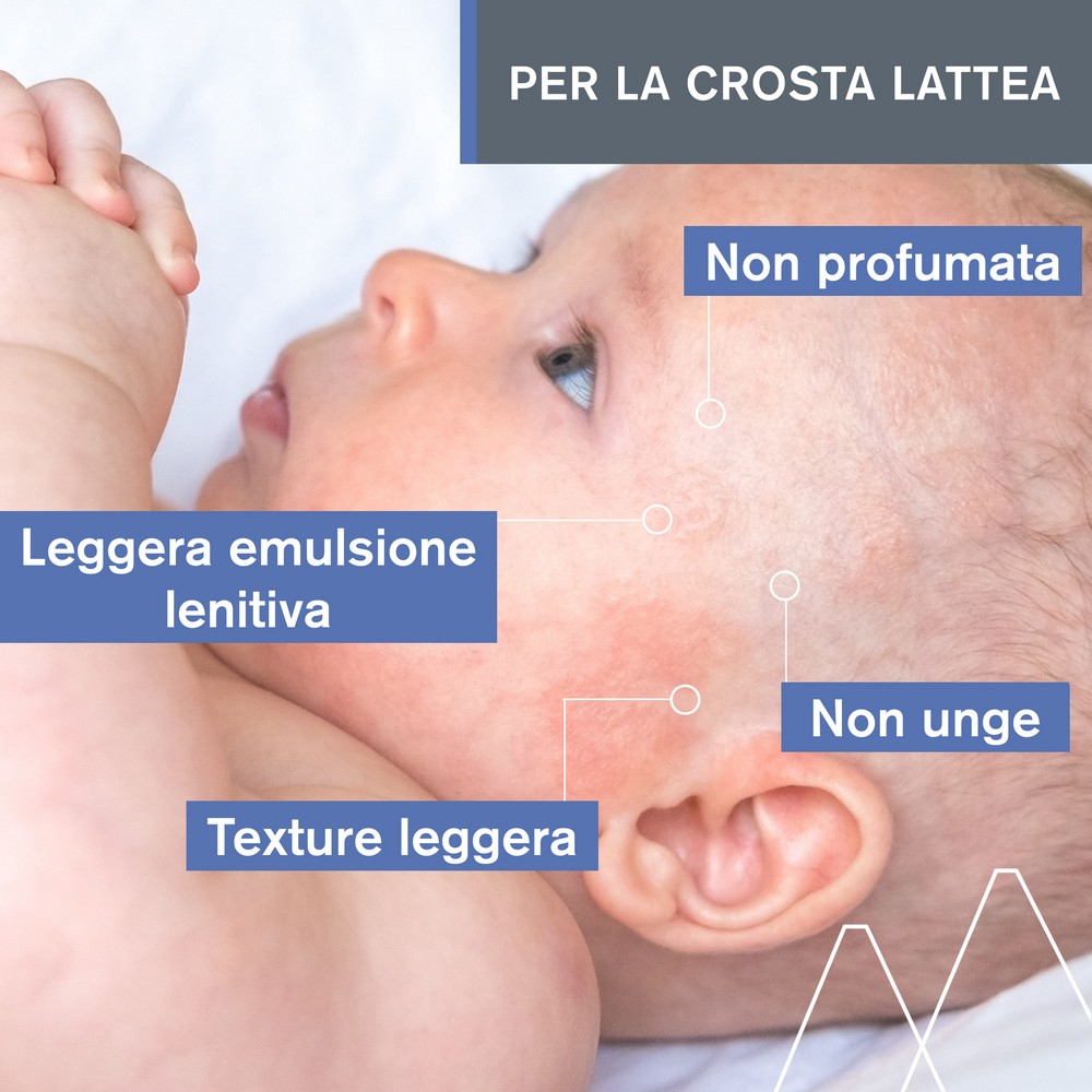 Uriage Bebè 1a Crema per il cuoio capelluto - 40 ml