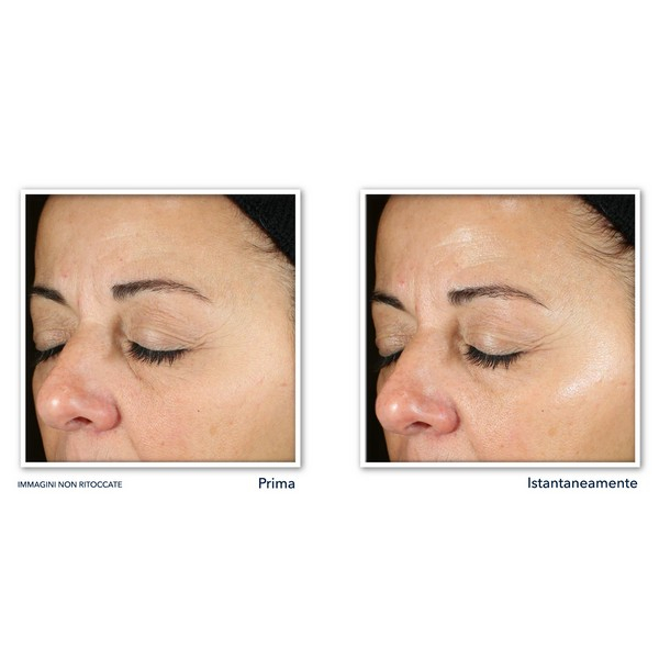 ROC Multi Correxion® Revive + Glow Siero Viso per pelle compatta, luminosa e uniforme - 30ml