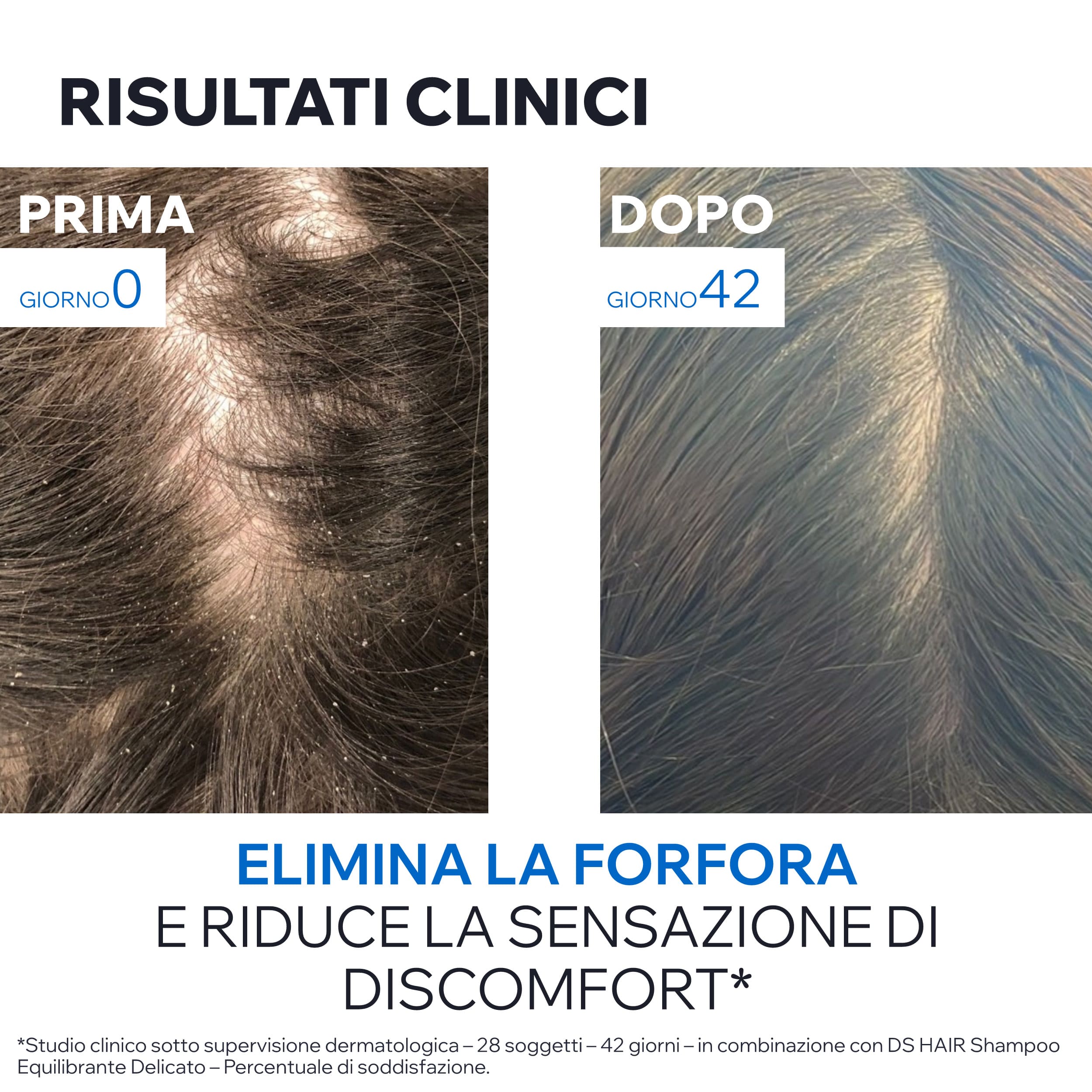 Uriage - DS Hair - Shampoo Antiforfora 500 ml