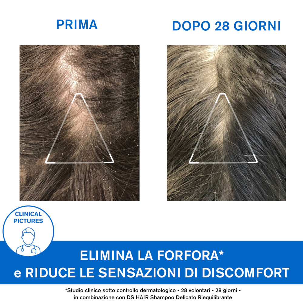 URIAGE D.S.Hair Sh.A-Forfora
