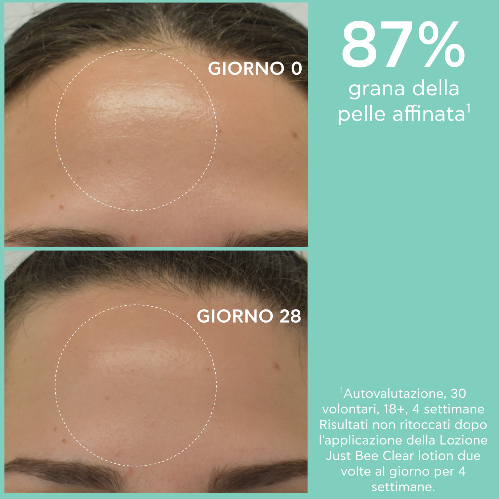 Apivita Just Bee Clear Lozione Purificante Minimizza i Pori