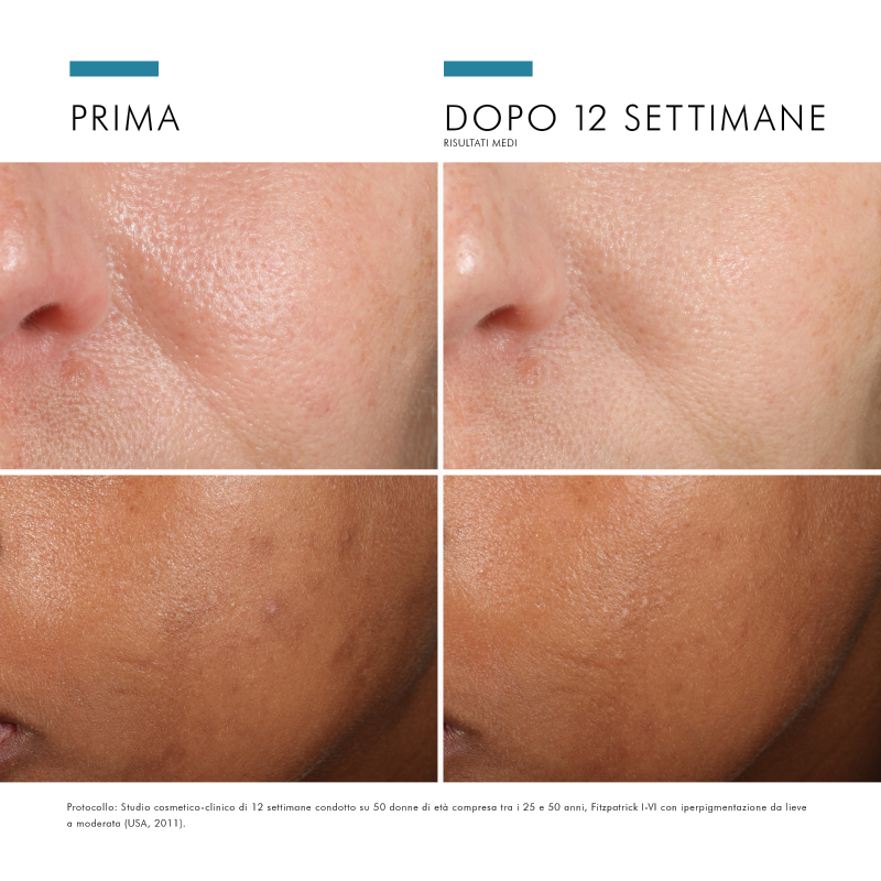 SkinCeuticals Phloretin CF Siero antiossidante per pelli iperpigmentate con 10% di Vitamina C pura 30 ml